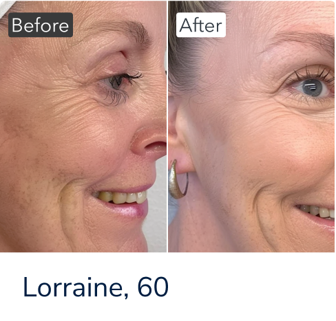 Day & Night Serum Set - The Very Good Goo